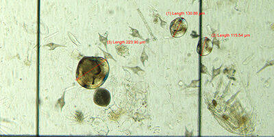 Microscopic view of water sample; three zebra mussel with lengths of 223, 130, and 115 micrometers are visible